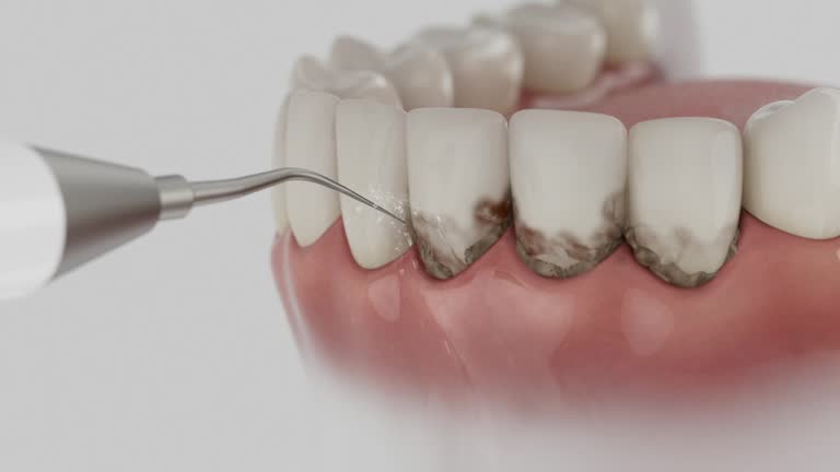 Trusted Dental Crowns And Bridges service in Edinburg, VA - Dentist Open Now